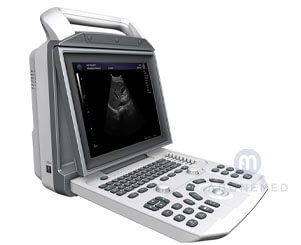 Portable ultrasound system zoncare-i50